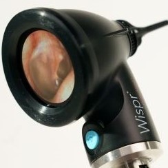 Digital Otoscope with Camera